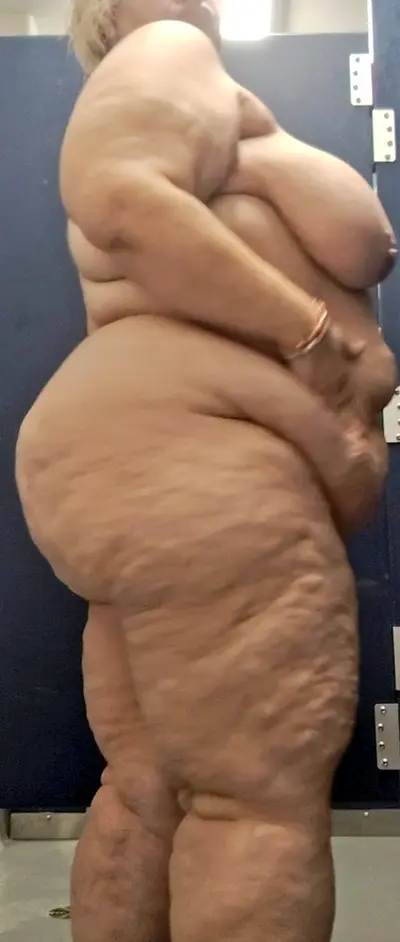 Cellulite SSBBW cover image