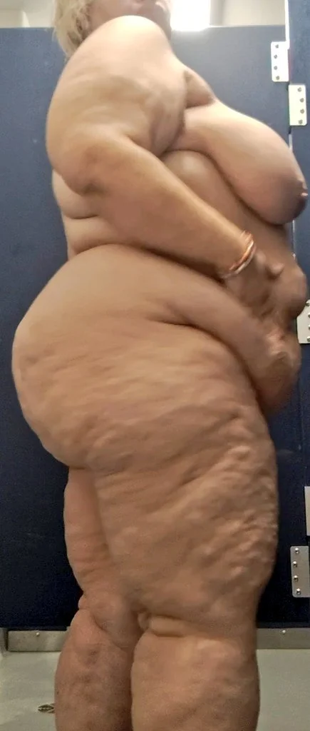 Cellulite SSBBW main image