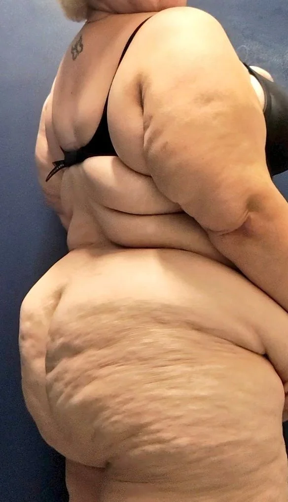 Cellulite SSBBW image 3