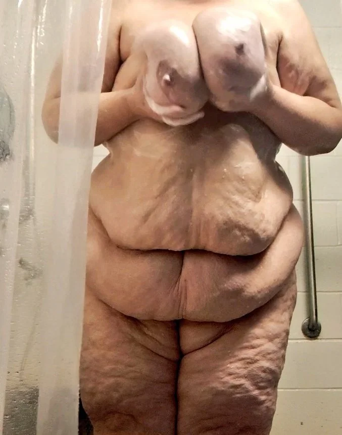 Cellulite SSBBW image 9