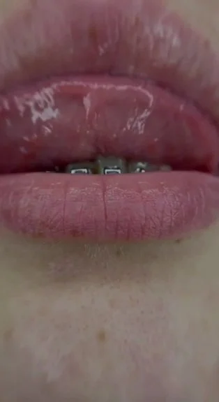 Fetish image 11