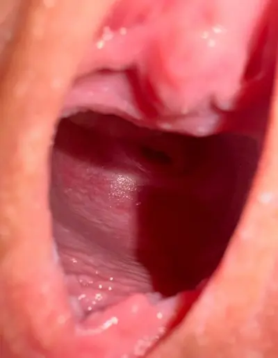 See an actual cervix for the first time cover image