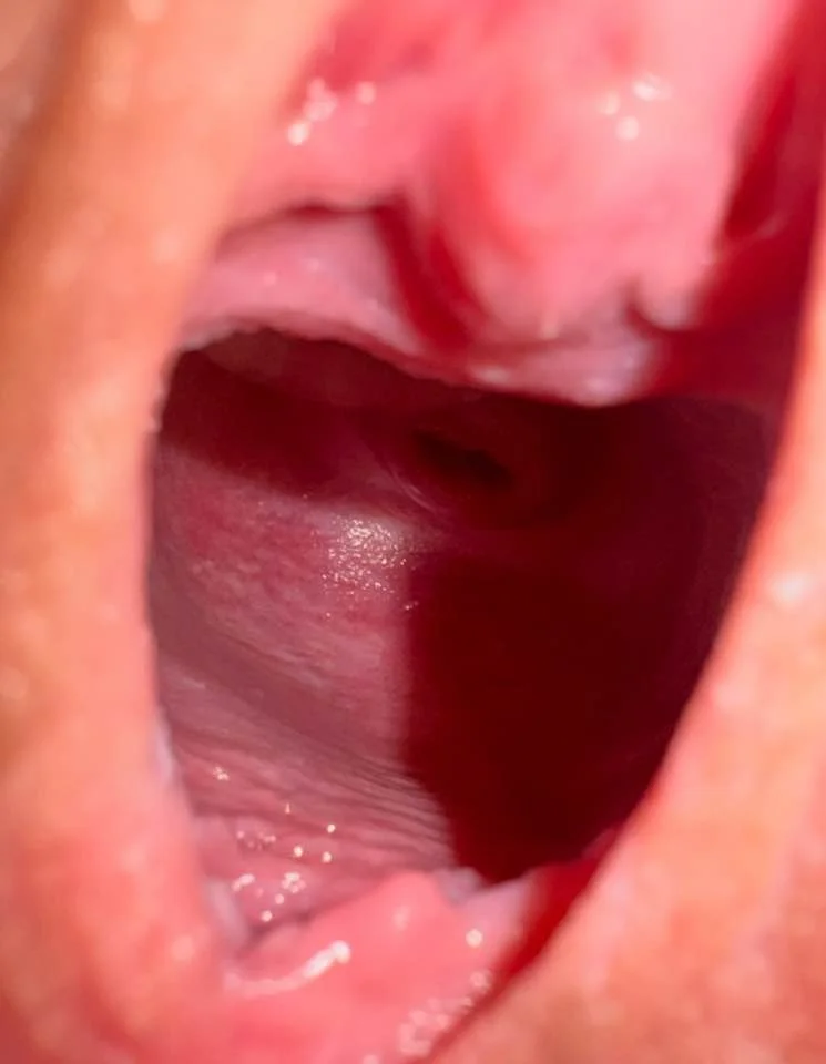See an actual cervix for the first time main image