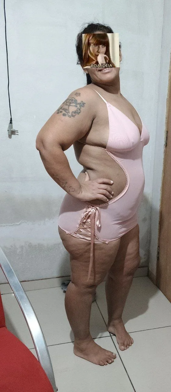 Coroa gordelicia vazada pelo corno DM image 4