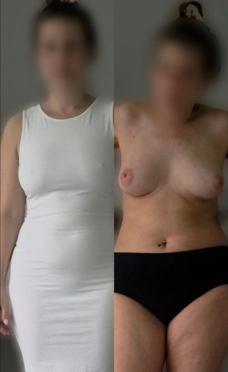 Dressed undressed image 3