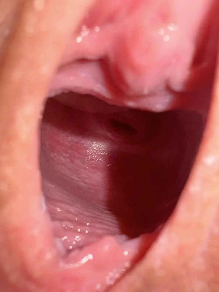 Ever seen a cervix? Now you have! main image